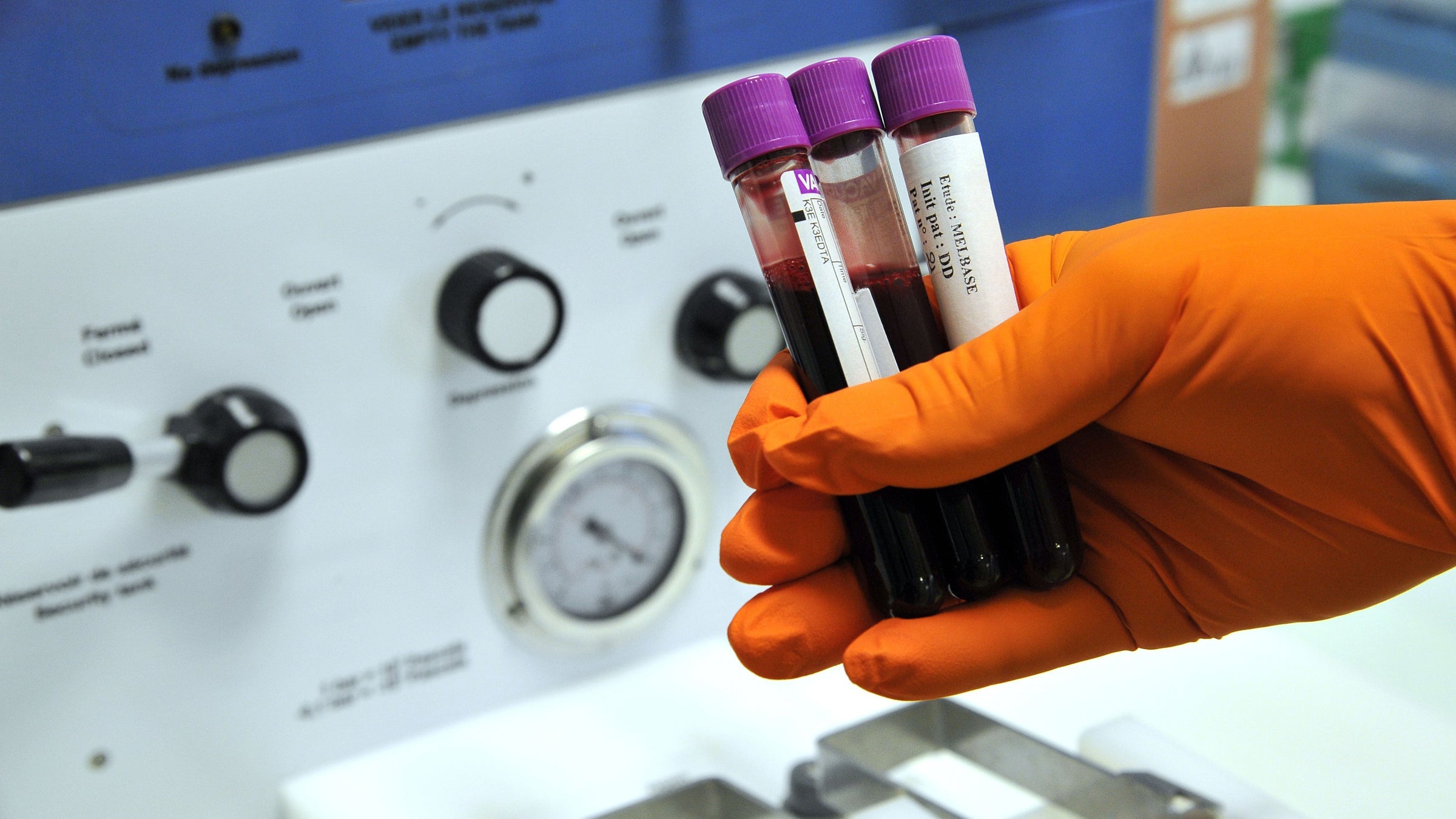 Suspicious values in blood tests rose dramtically when looking at athletes who had won Olympic or World Championship medals. 