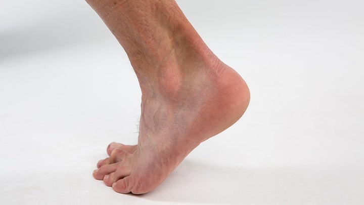 Achilles tendon