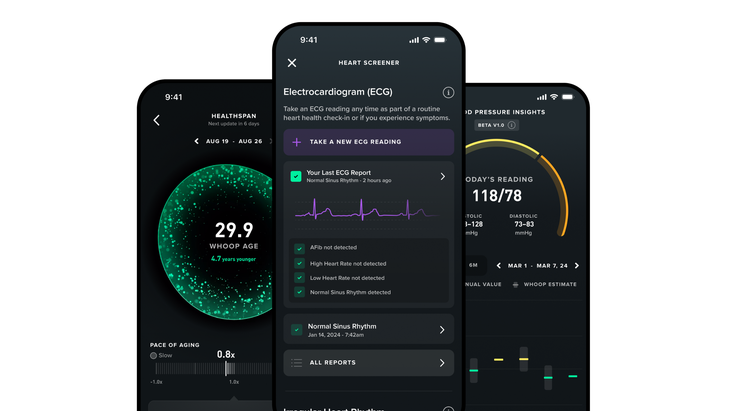 Whoop MG medical-grade insights