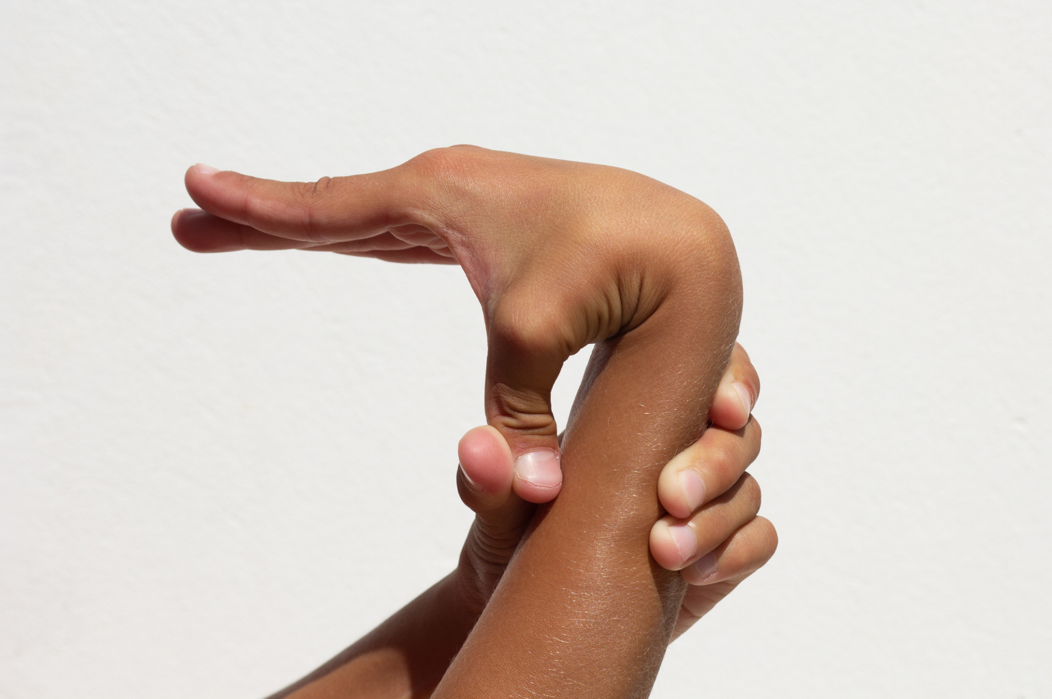 a very flexible thumb bending i the wrong direction to the person's wrist